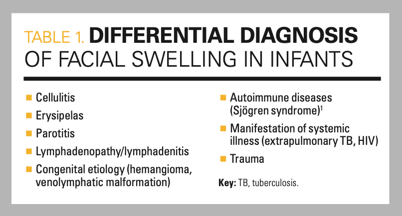 parotid gland swelling differential diagnosis
