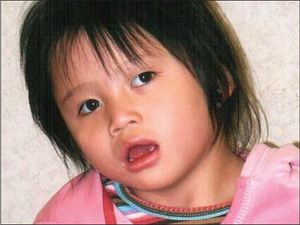 Happy 4-Year-Old Girl With Developmental Delays, Hand Flapping