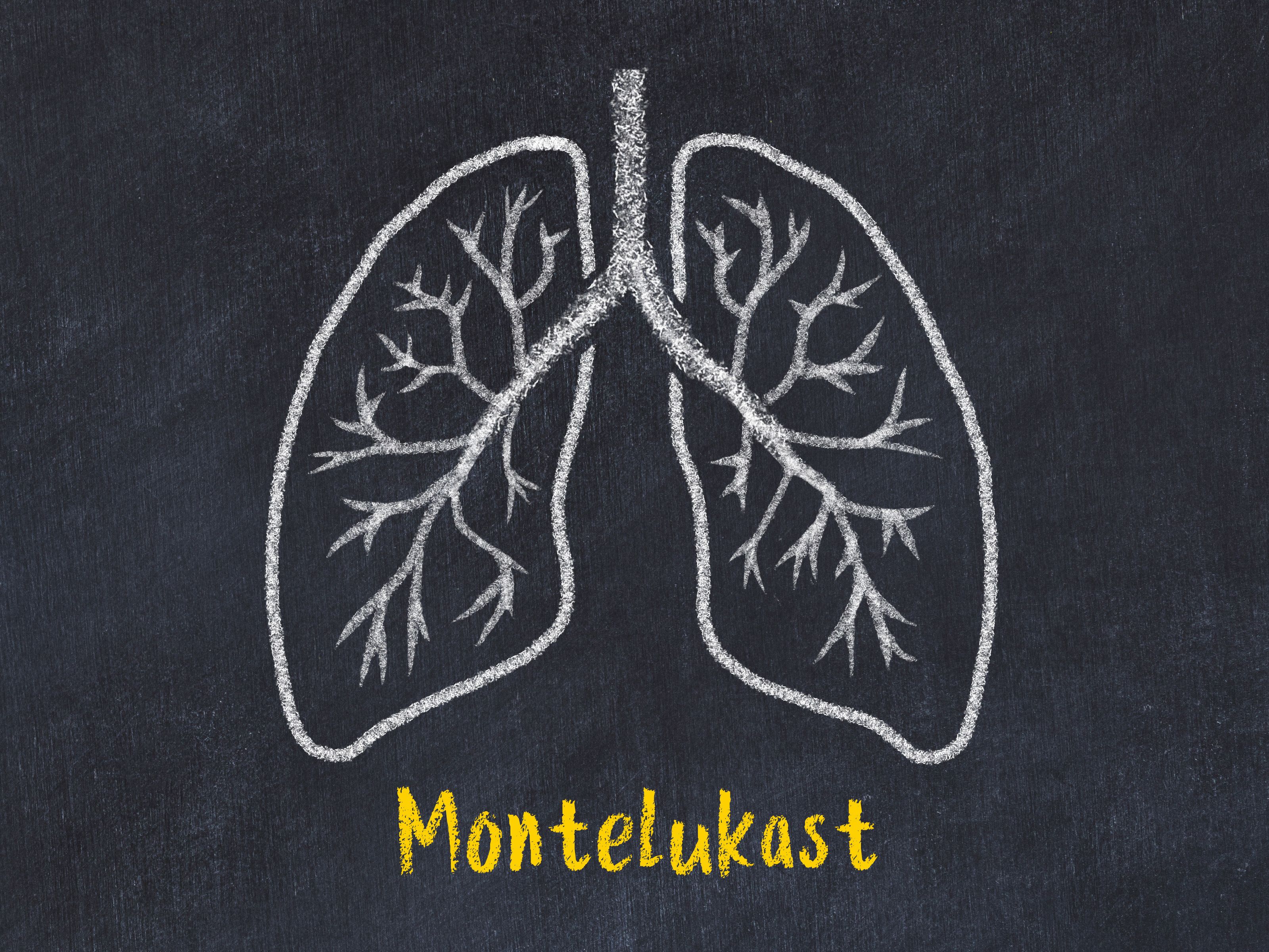 Study: No association between montelukast and neuropsychiatric adverse event risk | Image Credit: © iushakovsky - © iushakovsky - stock.adobe.com.