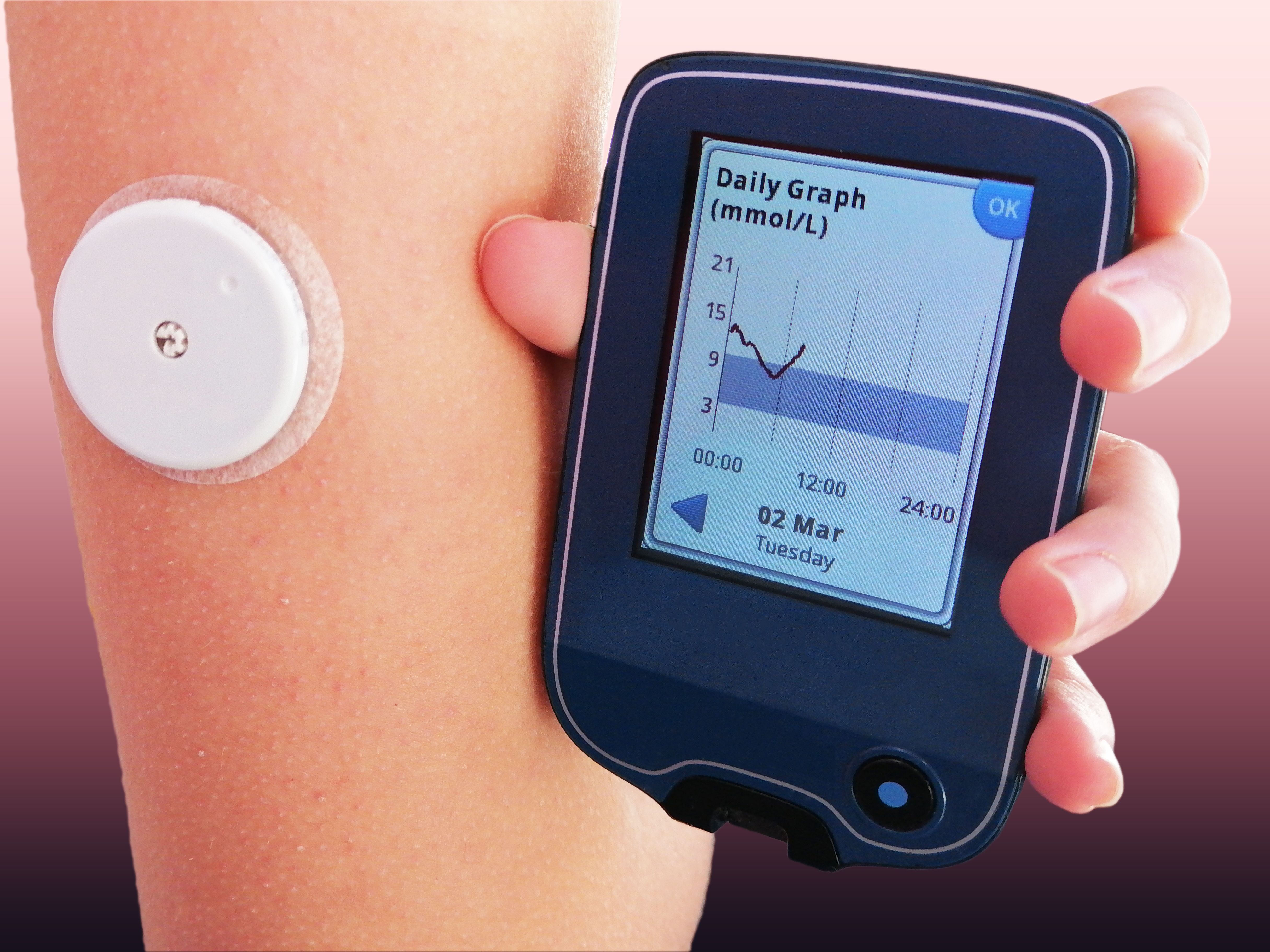 Continuous glucose monitors ease care for parents of young children ...