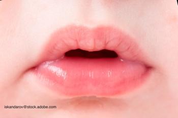 image of infant's mouth