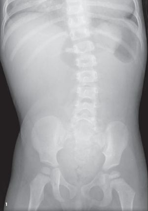 Repeated Episodes of Abdominal Pain Followed by Emesis in a 22-Month-Old