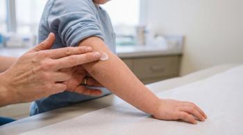Nonsteroidal topical therapies expand treatment options for pediatric skin conditions | Image Credit: © OCTOLENS - stock.adobe.com
