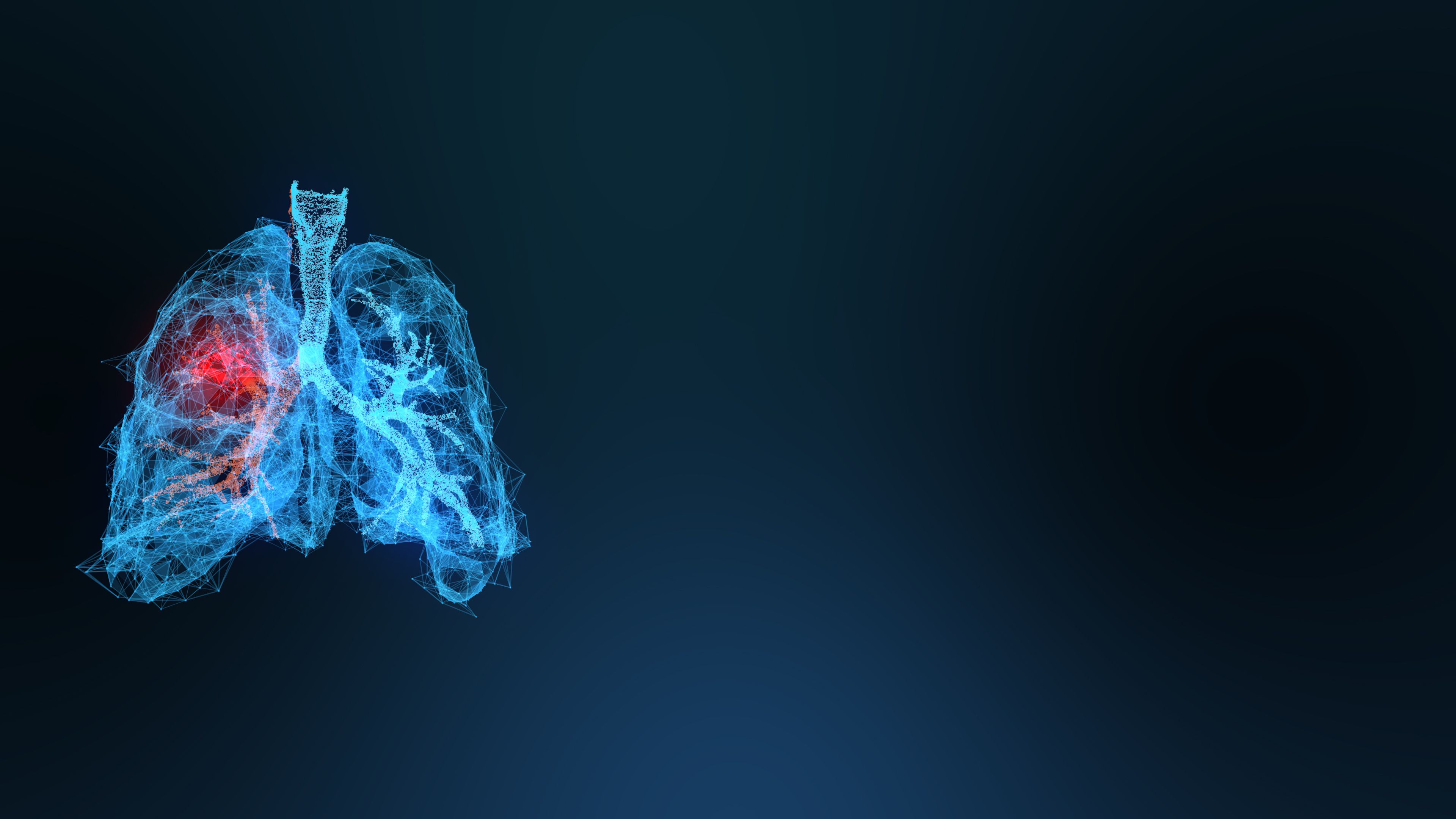 Ibuprofen not linked to lower mortality, bronchopulmonary dysplasia risk in infants | Image Credit: © appledesign - © appledesign - stock.adobe.com.