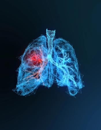 Ibuprofen not linked to lower mortality, bronchopulmonary dysplasia risk in infants | Image Credit: © appledesign - © appledesign - stock.adobe.com.