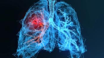 Ibuprofen not linked to lower mortality, bronchopulmonary dysplasia risk in infants | Image Credit: © appledesign - © appledesign - stock.adobe.com.