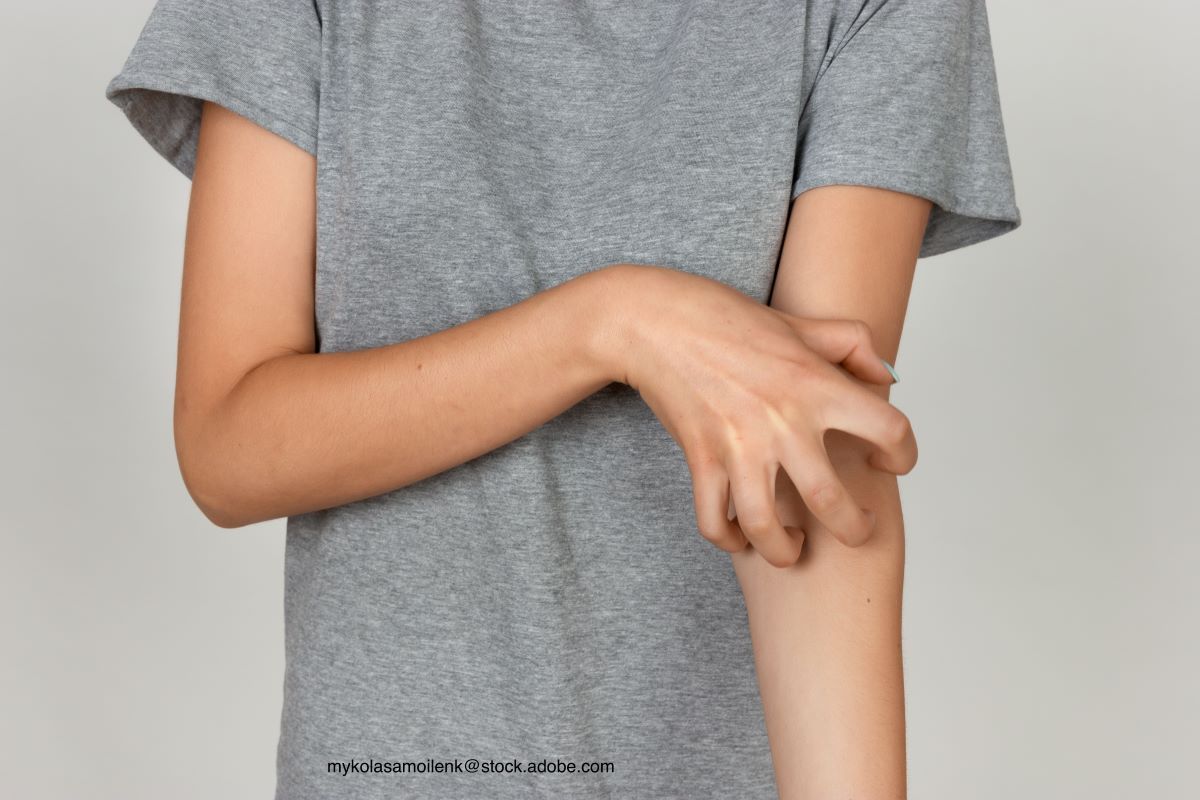child with itch