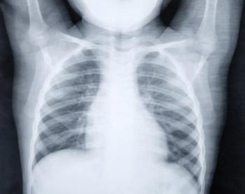 Pediatric pneumonia: Antibiotic use and treatment failureLatest revision | Image Credit: © dimas830 - © dimas830 - stock.adobe.com.