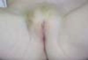 Pelvic Bruising in a Young Girl