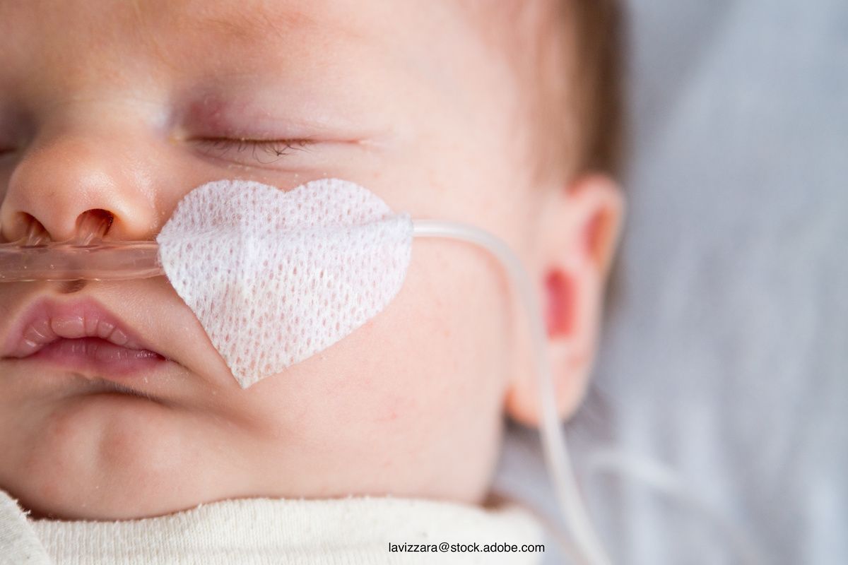baby on oxygen