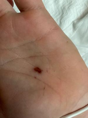 Muscle spasms in a 19-year-old male