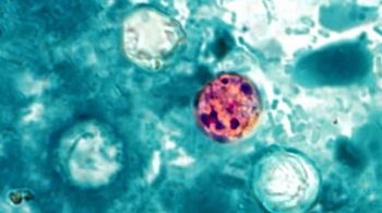 Cyclosporiasis in 2026: A clinical update for pediatricians | Image credit: © Centers for Disease Control and Prevention
