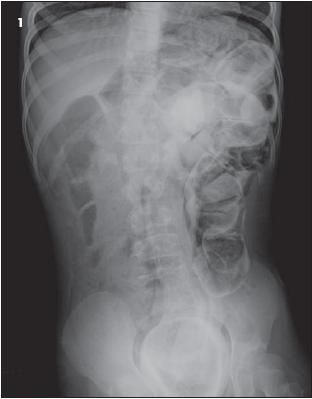 Papular Perianal Rash in an 8-Year-Old Girl
