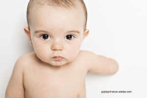 Congenital upper limb deficiency: A case report