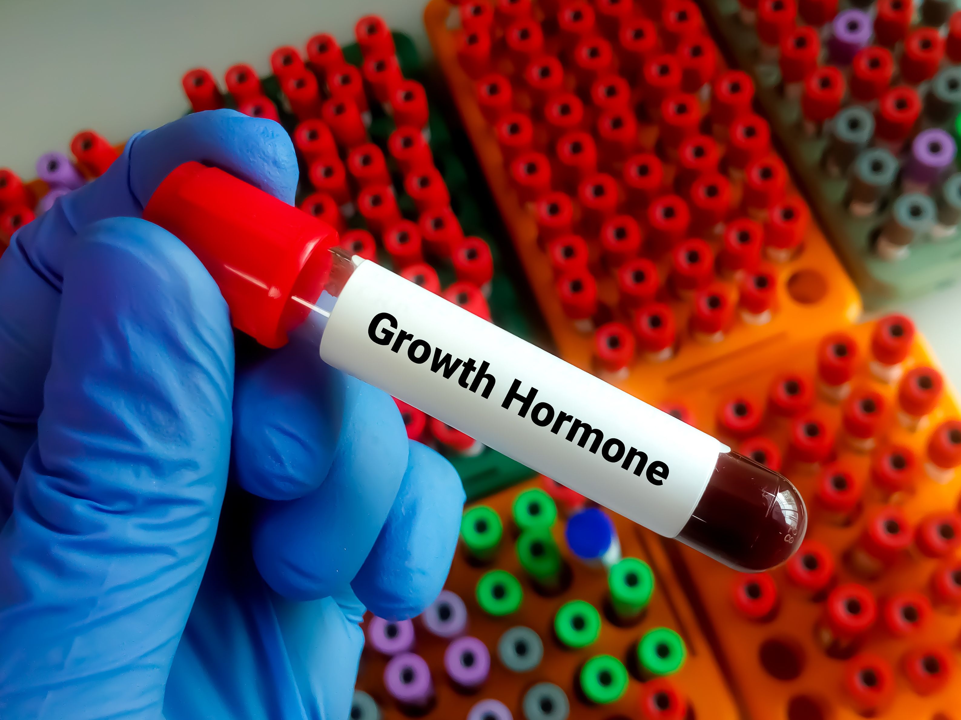 Phase 3 data show effectiveness of somapacitan in children with growth disorders | Image Credit: © Saiful52- © Saiful52  - stock.adobe.com.