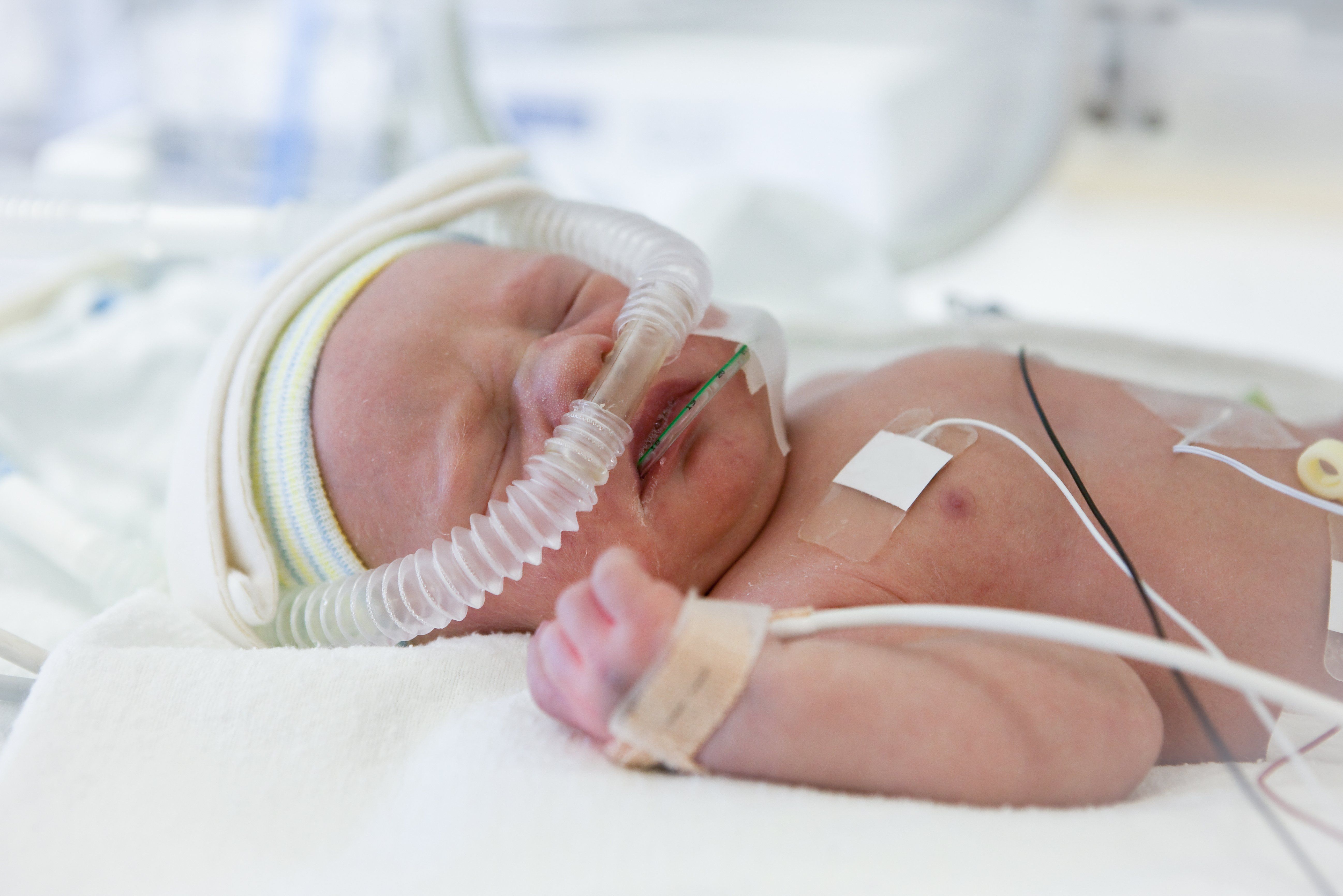 O2 Drop Baby Preemie oxygenation updates lack specific guidance