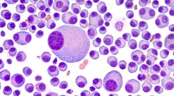 myeloms