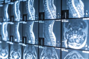 An image of head and neck cancer.