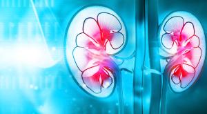 More Options in Renal Cell Carcinoma Treatment Means Greater Hope For Patients