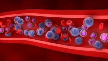 Annamycin plus cytarabine achieved a 40% preliminary remission rate in relapsed AML: © stock.adobe.com.