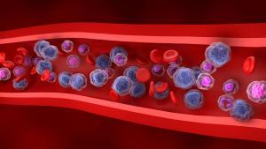 Annamycin plus cytarabine achieved a 40% preliminary remission rate in relapsed AML: © stock.adobe.com.