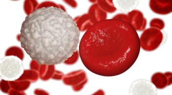 image of CLL