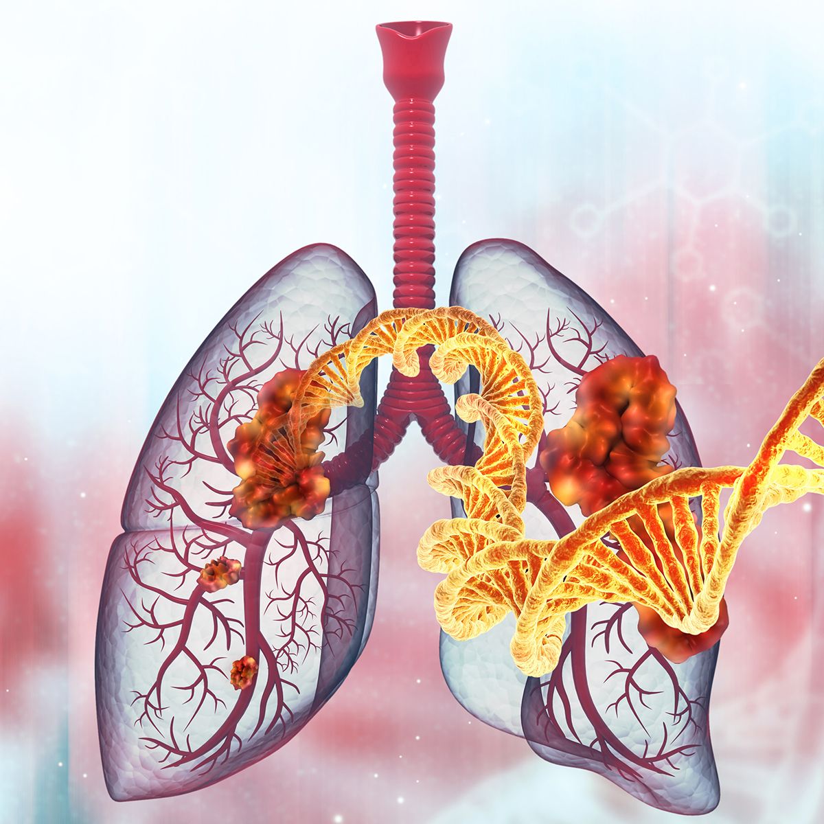Iza-bren and Tagrisso showed beneficial results as an initial treatment for advanced/metastatic EGFR-mutated NSCLC: © stock.adobe.com.