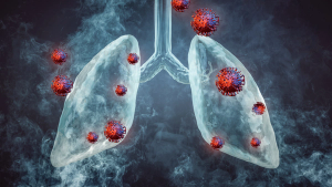 image of lung