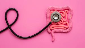 A phase 2 trial showed onvansertib plus FOLFIRI and Avastin improved response and disease control in first-line RAS-mutated metastatic colorectal cancer: © stock.adobe.com. 