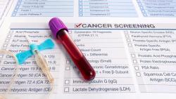 Stage 1 Multiple Myeloma Treatment Options and Side Effect Management