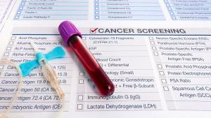 Get the facts on stage 1 multiple myeloma, including why your doctor may recommend active surveillance and what the latest treatment options are. 