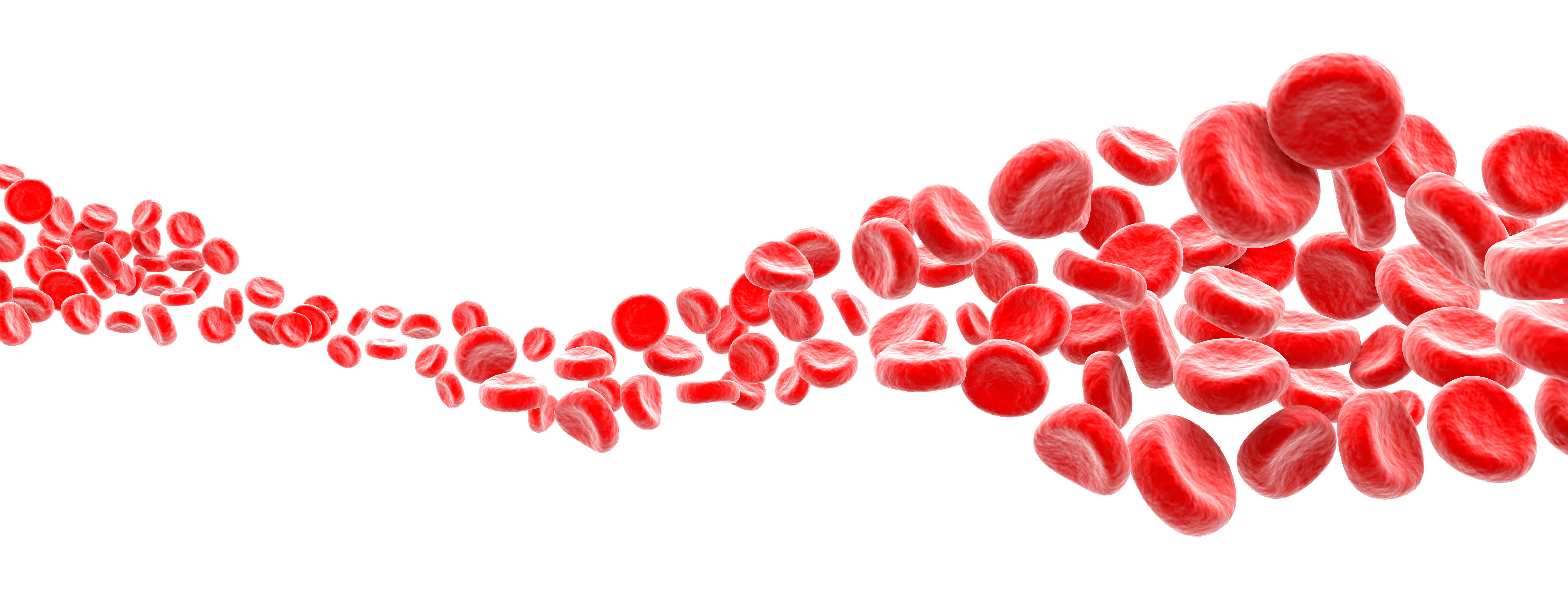 Clinical Trials on Smoldering Myeloma May Open Doors to More Precision Medicine Clinical Trials on Smoldering Myeloma May Open Doors to More Precision Medicine