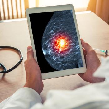 Bria-IMT plus check point inhibitors outperformed antibody-drug conjugates in HR+ metastatic breast cancer: © steph photographies - stock.adobe.com.