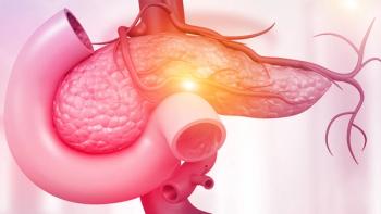 Elraglusib plus chemotherapy doubled one-year survival in metastatic pancreatic cancer, showing improved outcomes in a phase 2 trial: © stock.adobe.com.