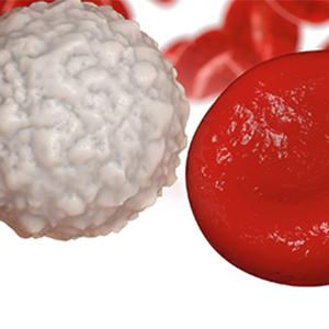 Combination Immunotherapy Being Investigated in Advanced Melanoma