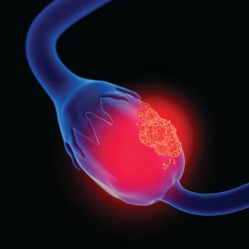 Image of ovaries.