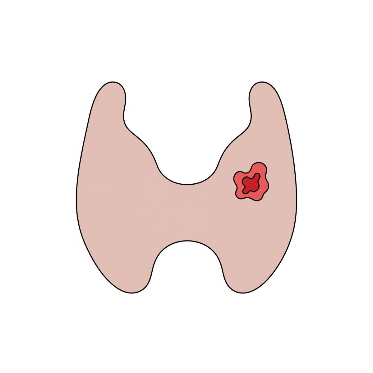 image of a thyroid