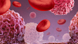 Understanding Stage 2 Myeloma with Treatment and Next Steps Explained