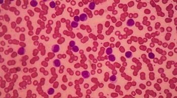 Illustration of CLL cells.