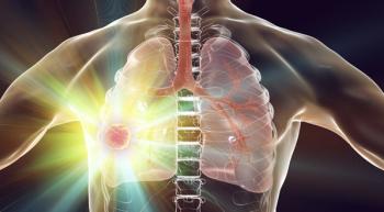 Image of a tumor in the right lung.