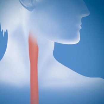 Illustration of throat.