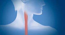 Different Esophageal Cancer Surgery Types Have Similar Outcomes