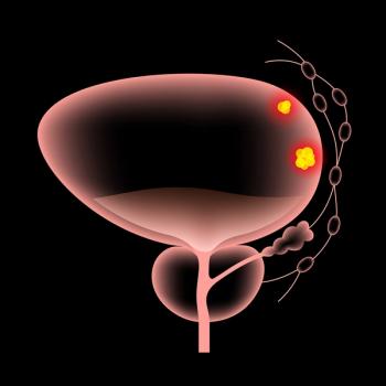 Image of a bladder