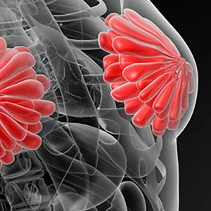 Lifestyle Changes Can Reduce Breast Cancer Risk