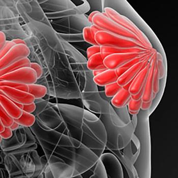 image of breast cancer x ray