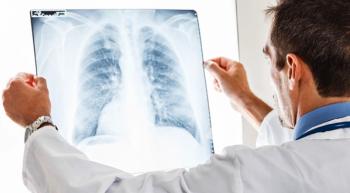 Picture of Doctor holding up X-ray of lungs.
