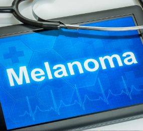 melanoma written on an ipad