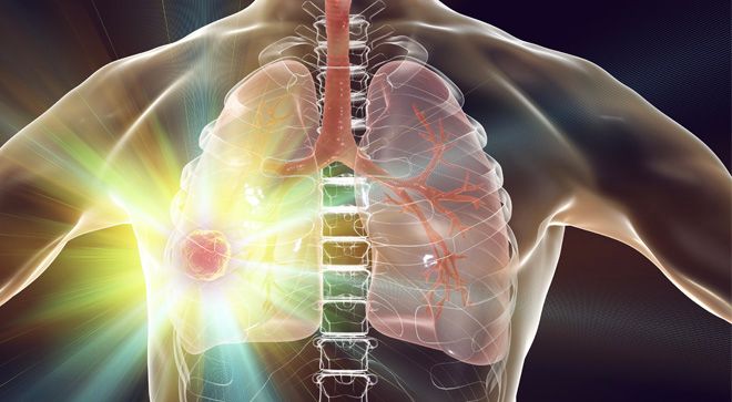lungs