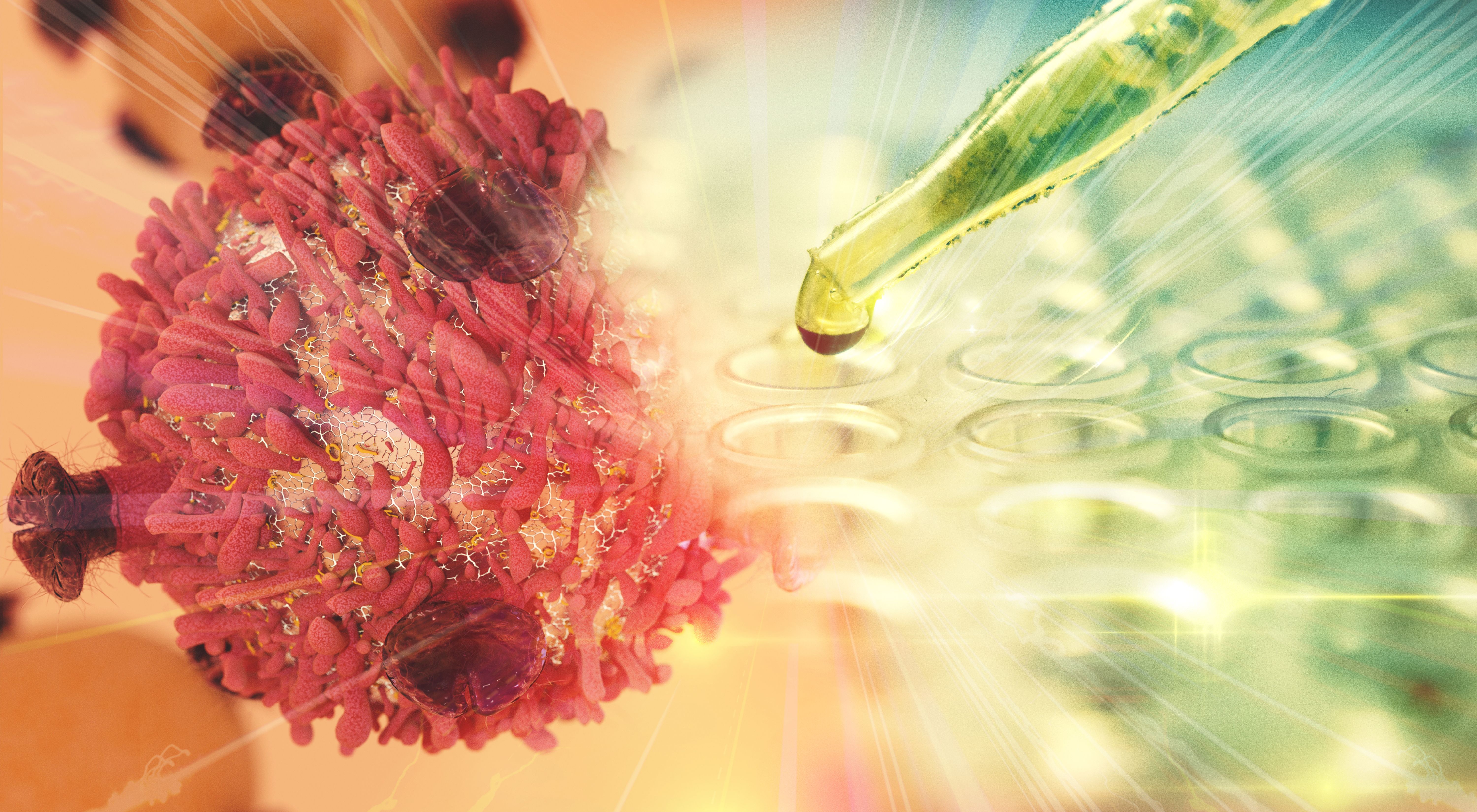 Bavencio May Be Effective in Preventing Relapse in Women With Gestational Trophoblastic Tumors