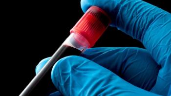 blood sample